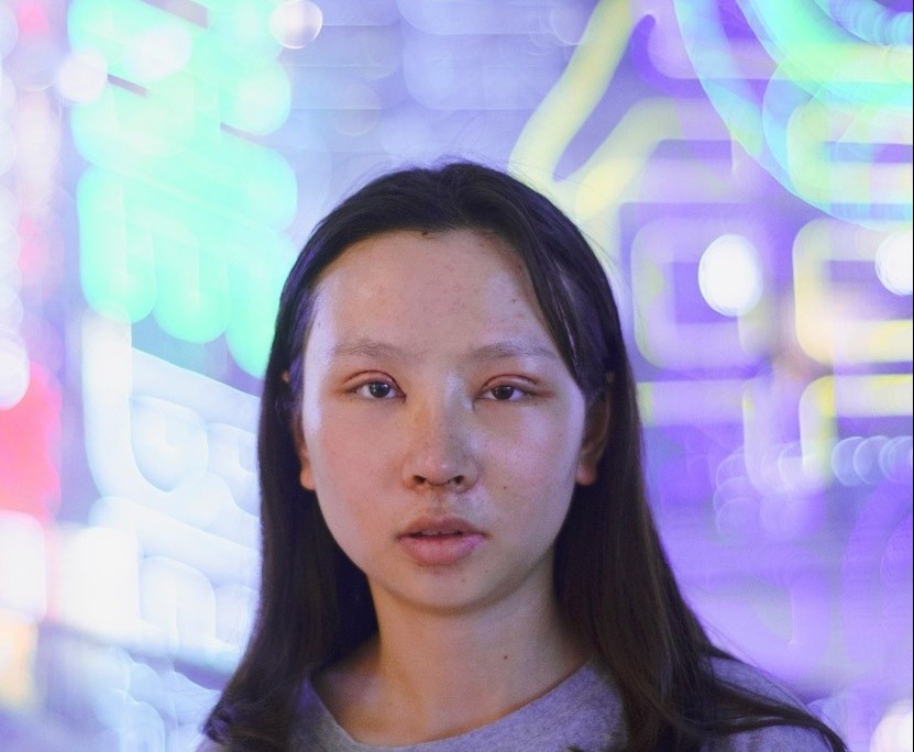 Cam do doi doi nho phau thuat tham my o Trung Quoc hinh anh