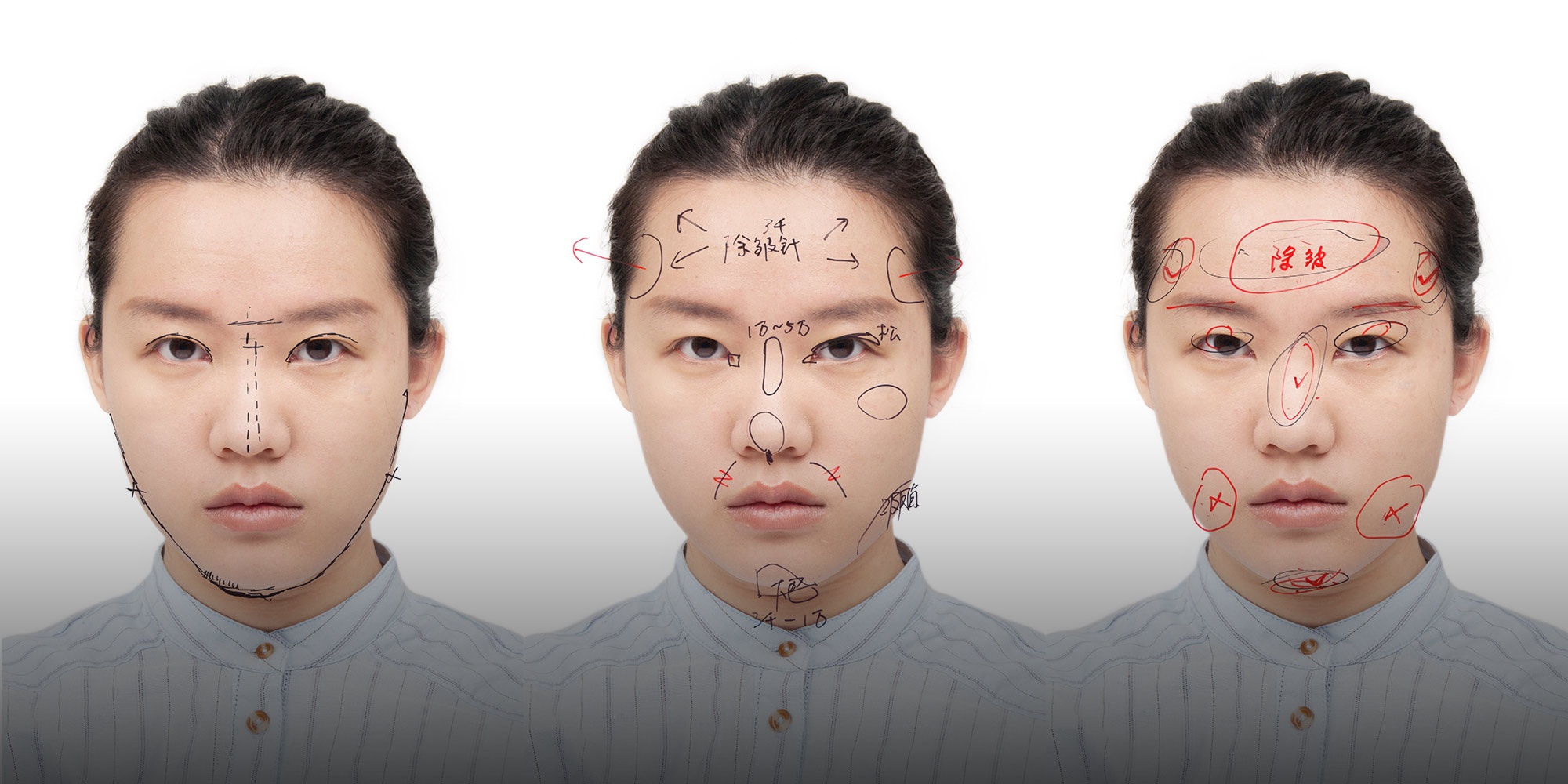 Phẫu thuật thẩm mỹ ảnh 2 Phau thuat tham my anh 2