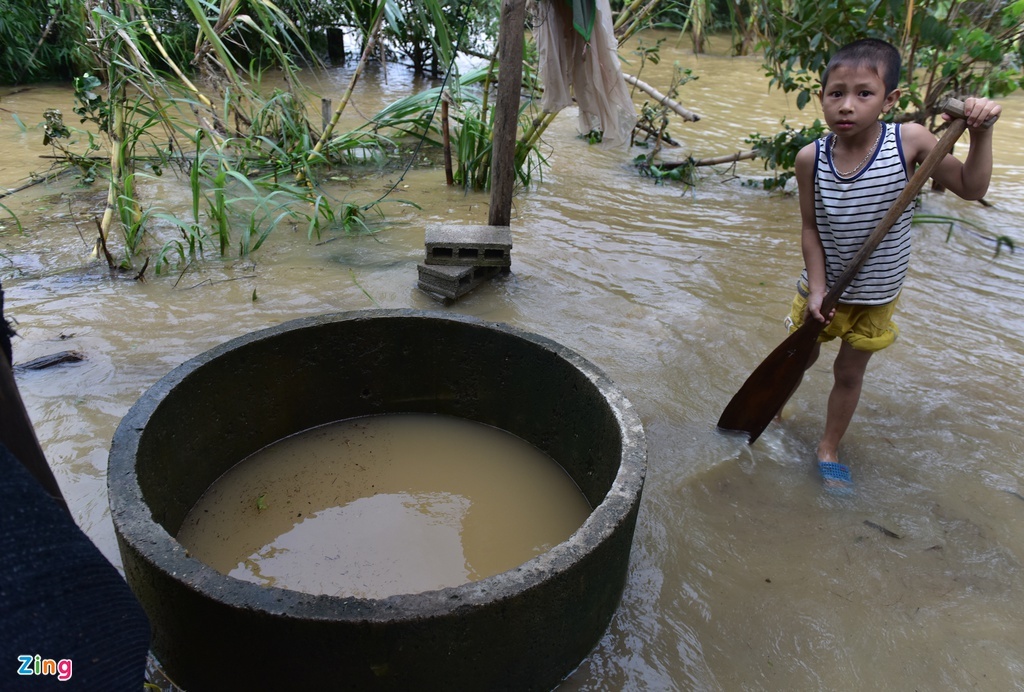 bung phat benh truyen nhiem sau lu anh 2