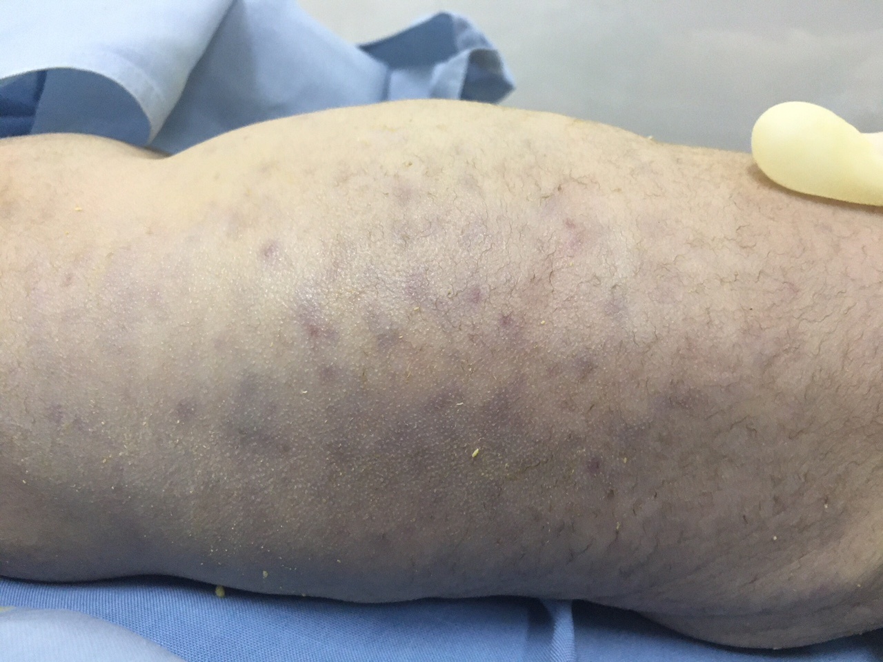 Virus de gay tu vong va di tat cho thai khi me bi nhiem hinh anh