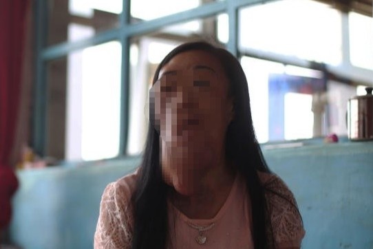 Nguoi phu nu o Trung Quoc mang 'khuon mat voi' hinh anh