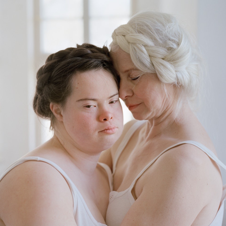 nguoi mac chung Down anh 1