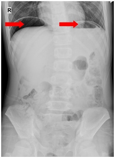 thung da day vi thoi quen an cay anh 1