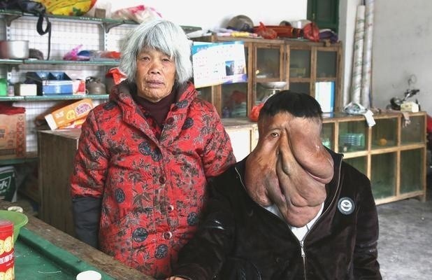 hang nghin khoi u bao phu anh 3