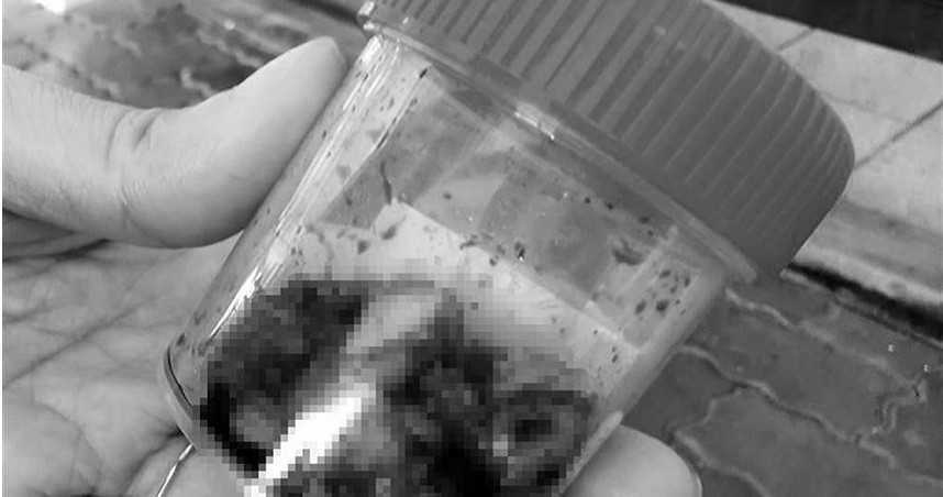 tu vong sau khi nho 20 chiec rang anh 1