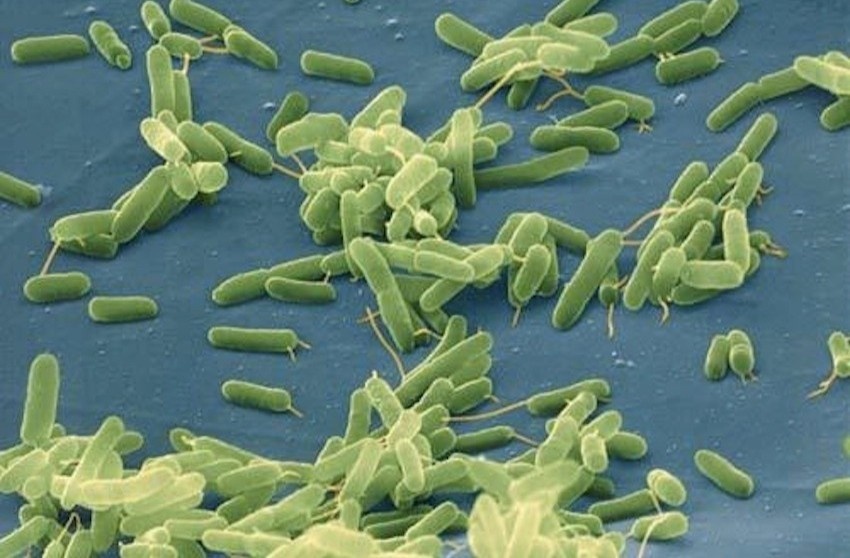 Vi khuan 'an thit nguoi' tru an trong hau song hinh anh