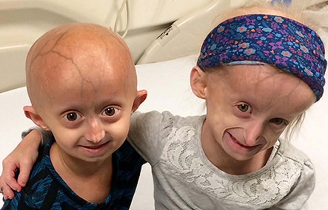 Thuoc dau tien tren the gioi chua benh lao hoa som hinh anh