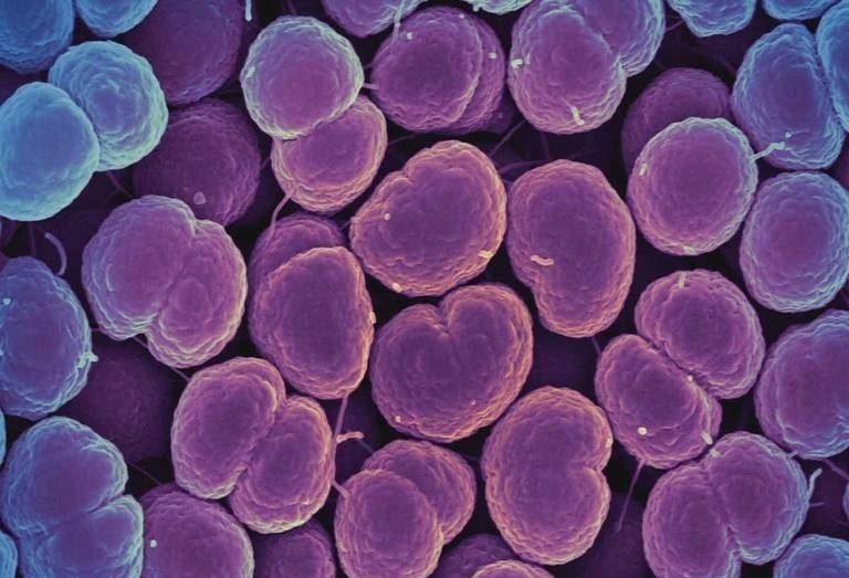 Bien chung hiem gap cua benh lau hinh anh