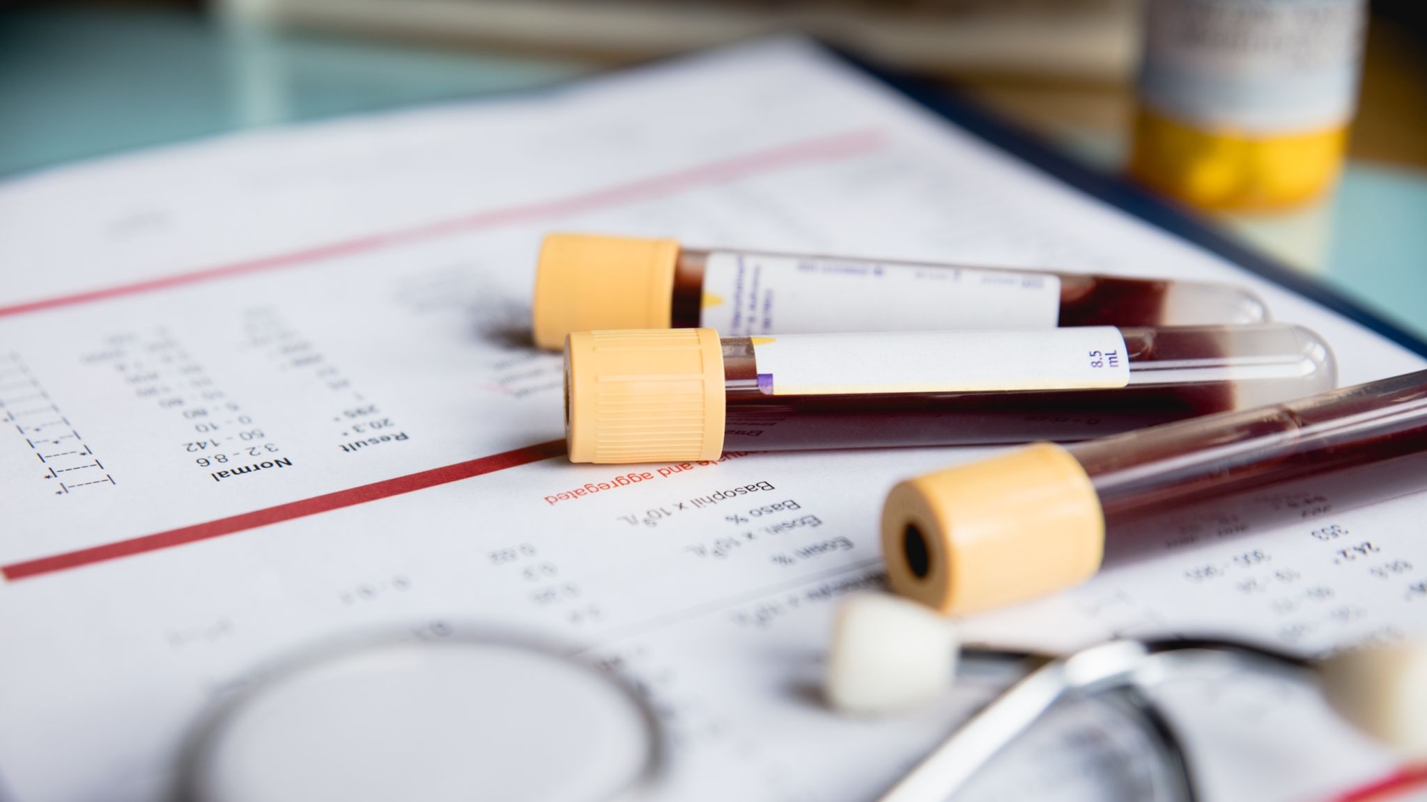 Xet nghiem mau co the phat hien 50 loai ung thu hinh anh