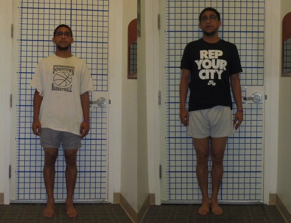 phau thuat keo dai chan anh 1