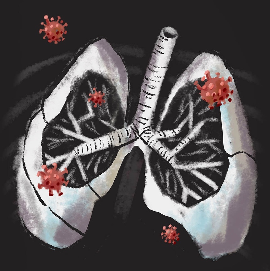 benh nhan so 0 anh 4