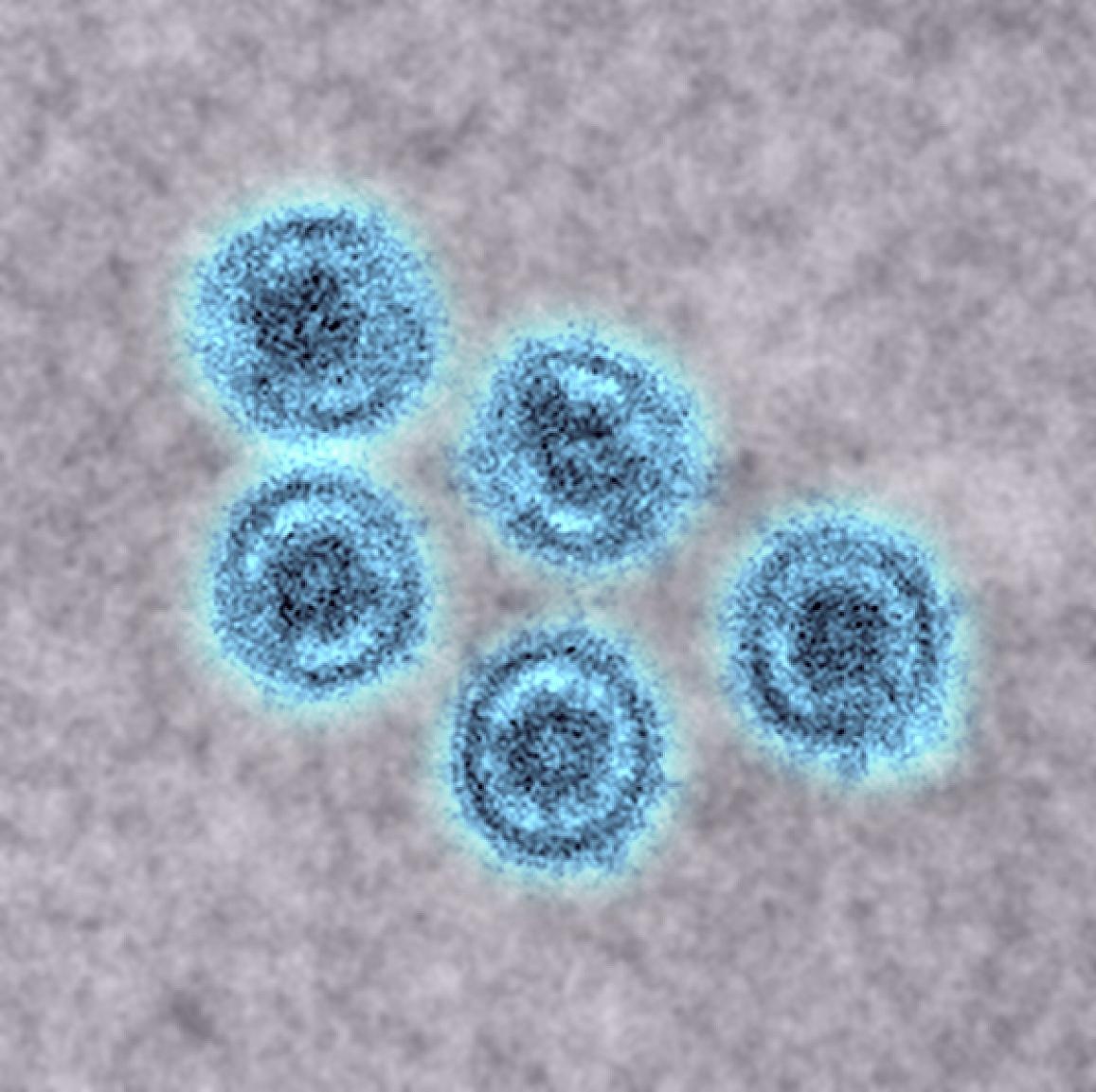 Virus Ebola anh 1