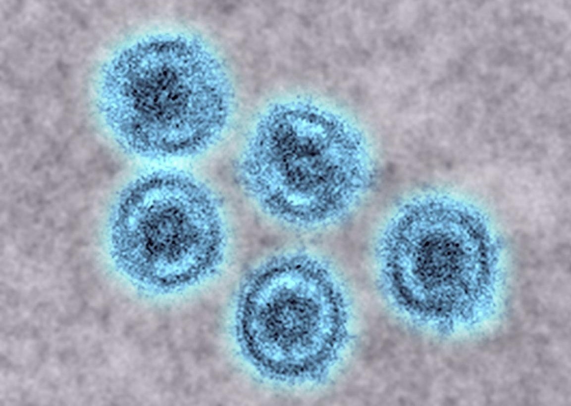 Lo ngai chung virus Ebola co kha nang lay sang nguoi hinh anh