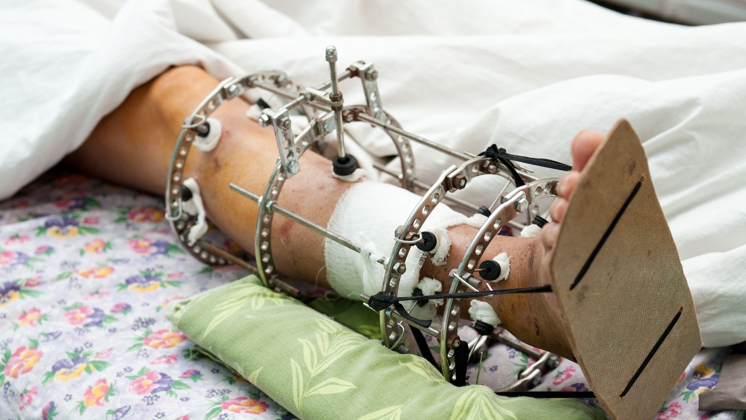 kéo dài chân ảnh 2 keo dai chan anh 2