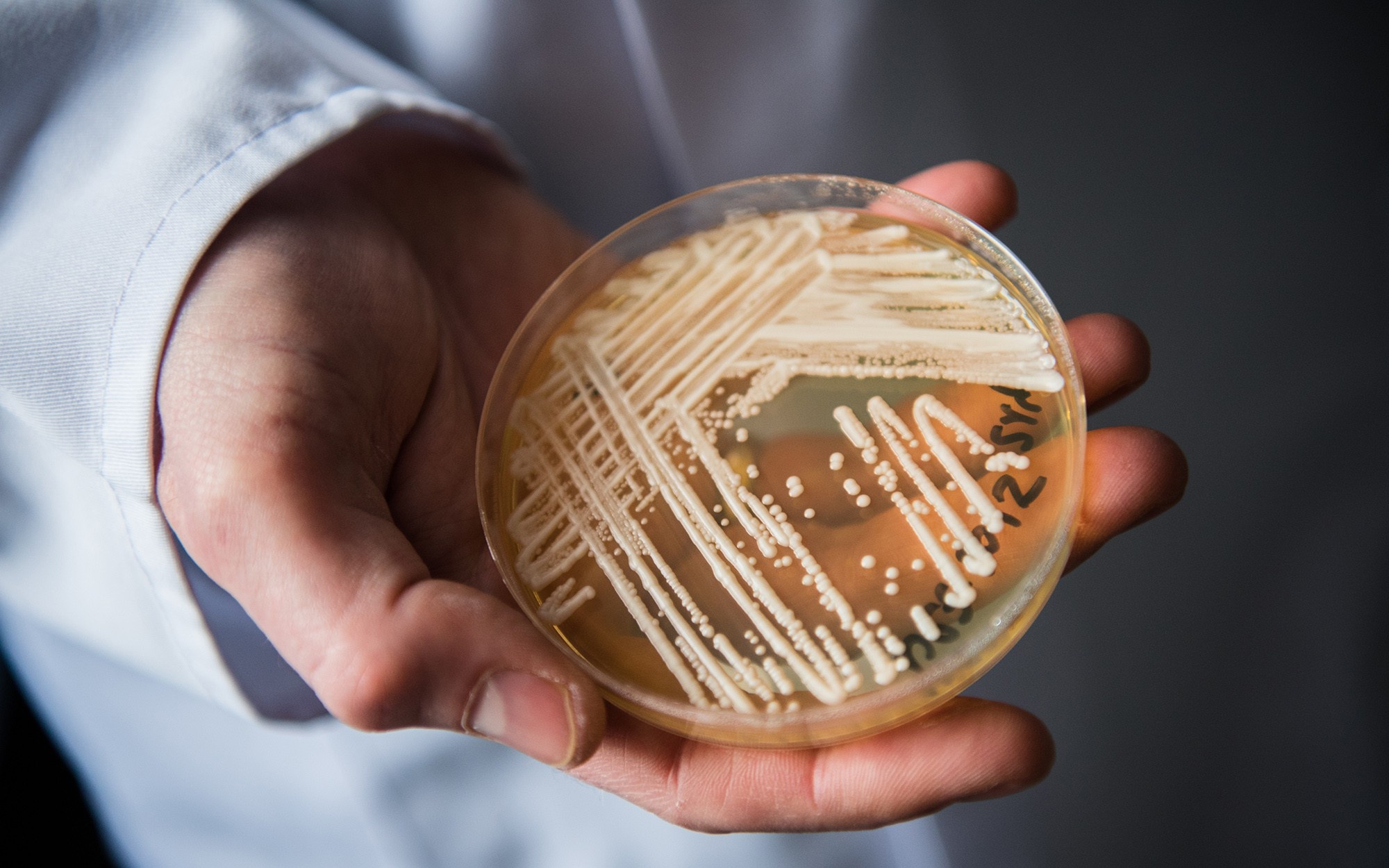 Chung nam sat thu bi an tren hang loat benh nhan Covid-19 tai My hinh anh