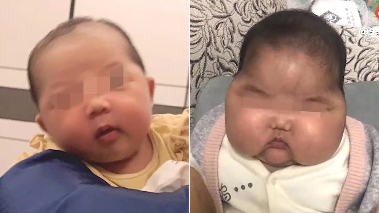 Biến dạng mặt sau khi dùng kem dưỡng ảnh 1 Bien dang mat sau khi dung kem duong anh 1