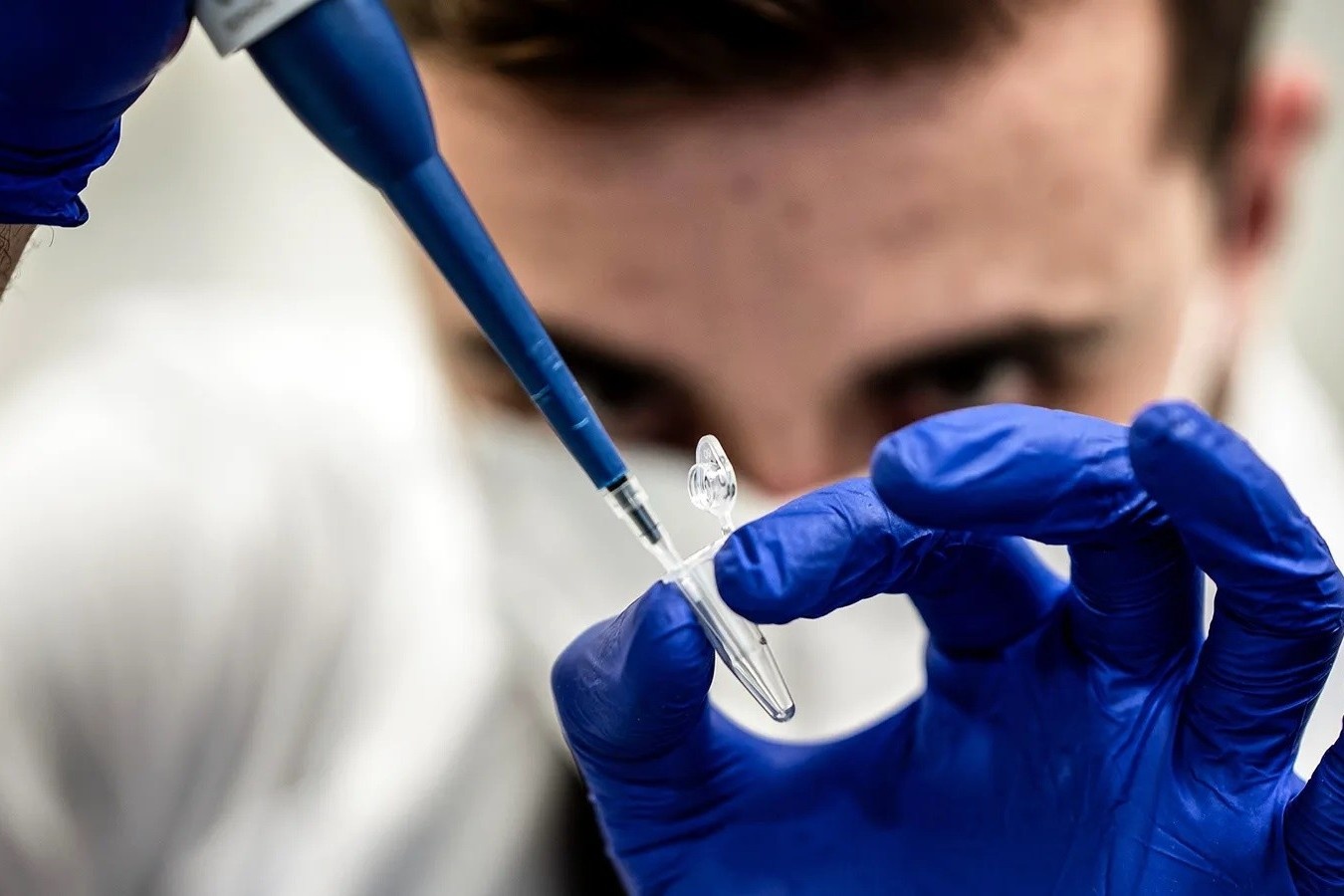 Hang loat bien chung SARS-CoV-2 xuat hien canh bao dieu gi? hinh anh