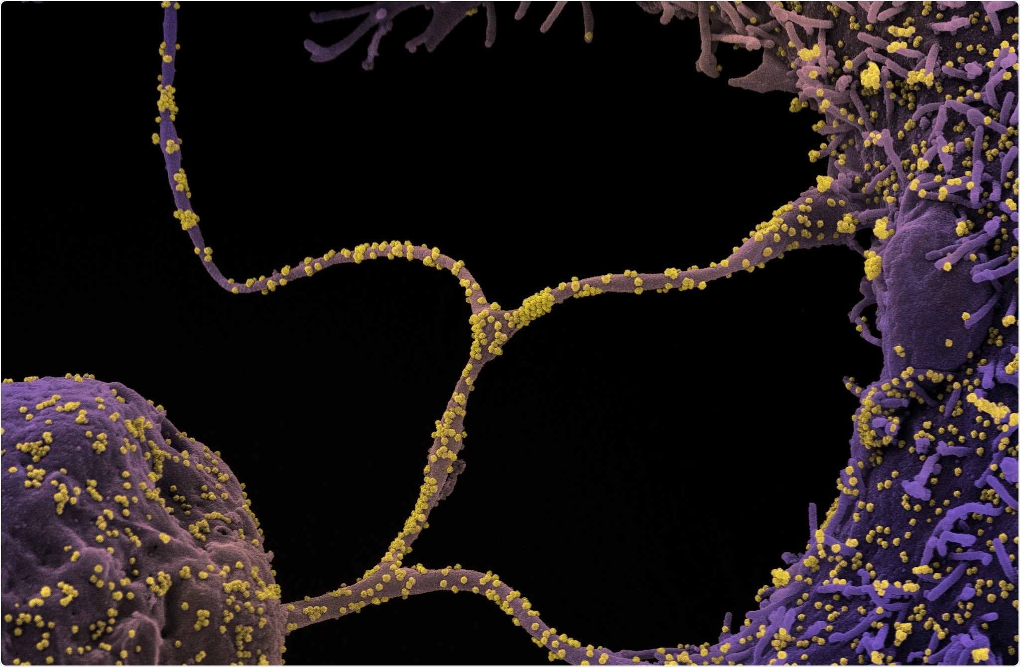 chung SARS-CoV-2 tai Anh chua dot bien khang vaccine anh 1