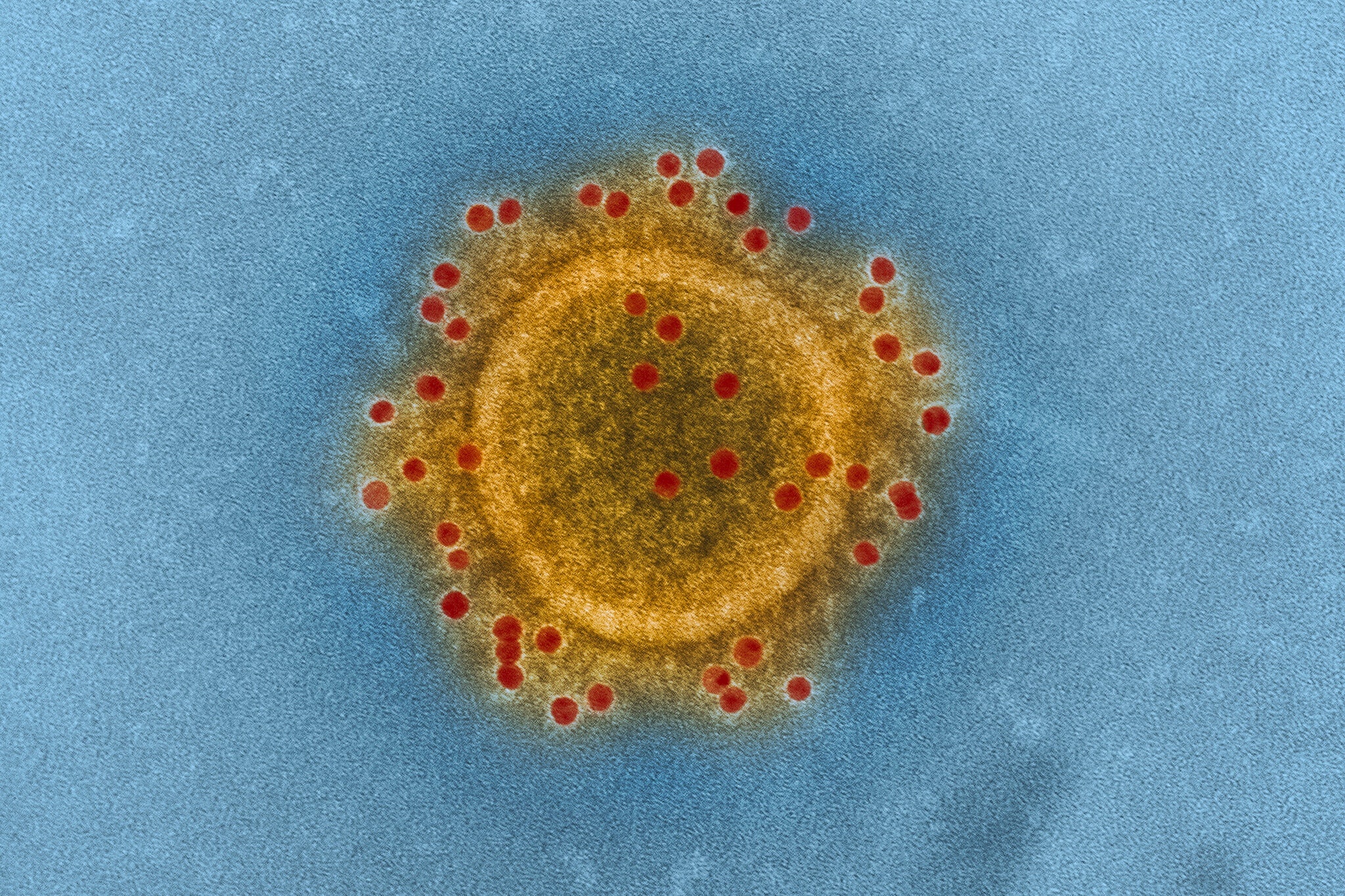 vaccine chong lai moi chung virus corona anh 2