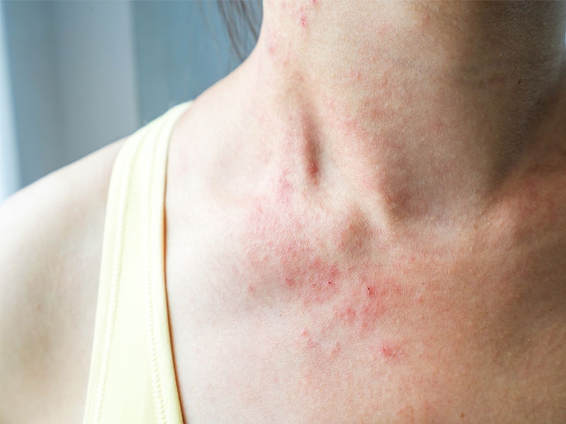 Ai không được tắm lá mùi? ảnh 3 Ai khong duoc tam la mui? anh 3