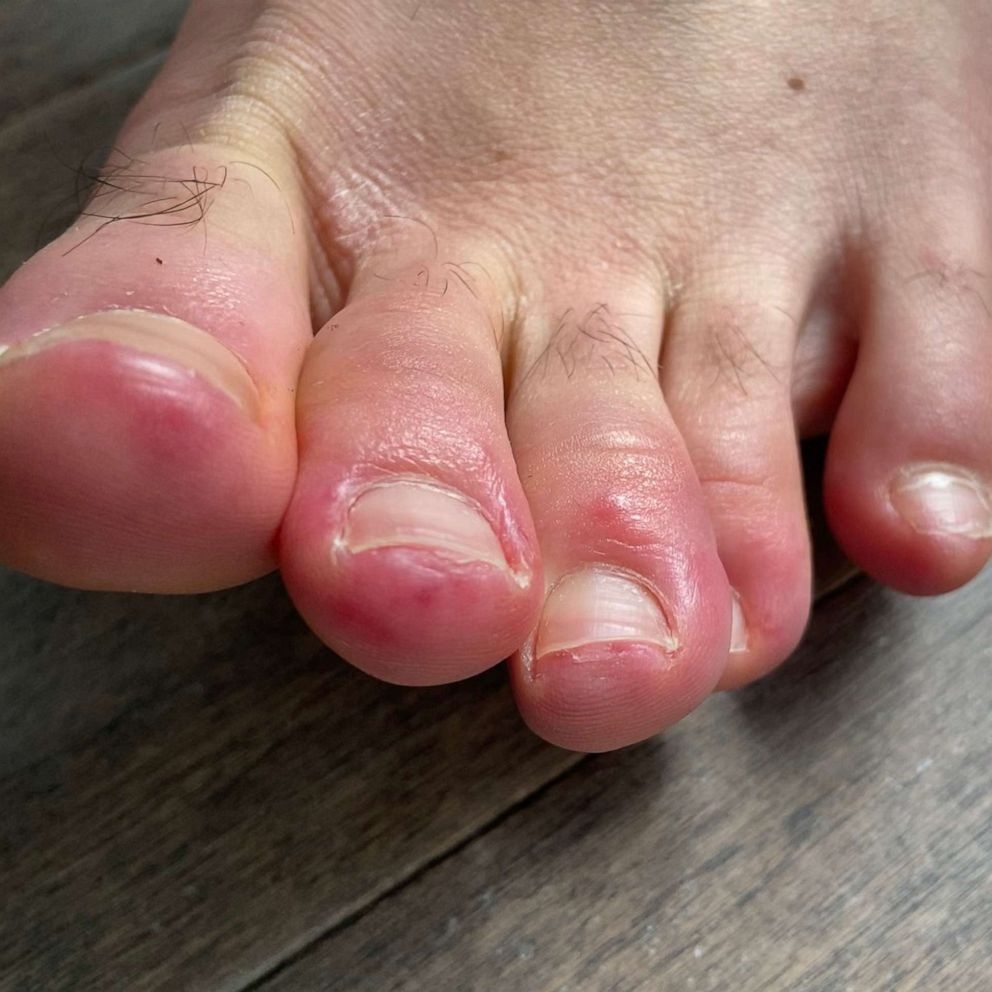 cach co the phat hien nguoi nghi mac Covid-19 anh 2