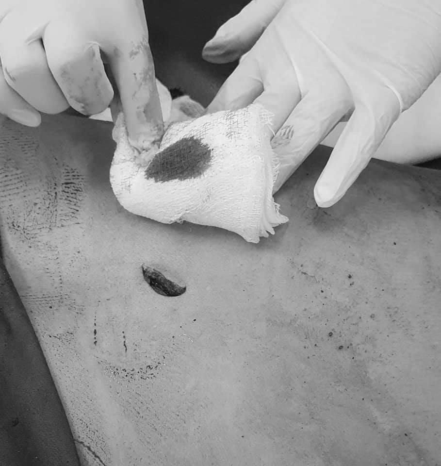 người đàn ông bị vết thương thấu tim ảnh 1 nguoi dan ong bi vet thuong thau tim anh 1
