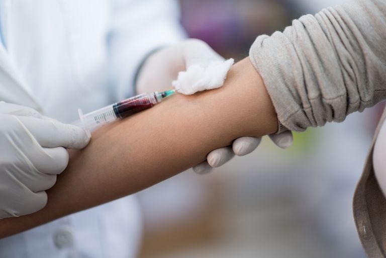 Dấu hiệu phát hiện nhiễm HIV ở nam giới ảnh 1 Dau hieu phat hien nhiem HIV o nam gioi anh 1