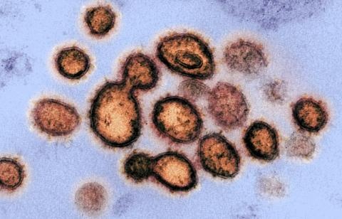 Xuat hien chung virus corona giong nCoV den 94,5% hinh anh