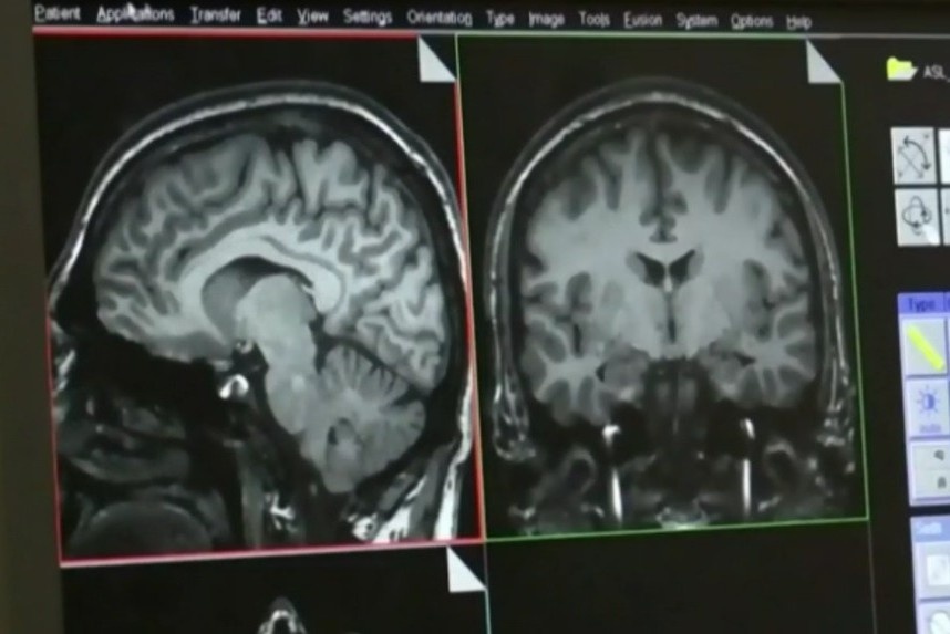 Can benh bi an gay chet nguoi tai Canada hinh anh