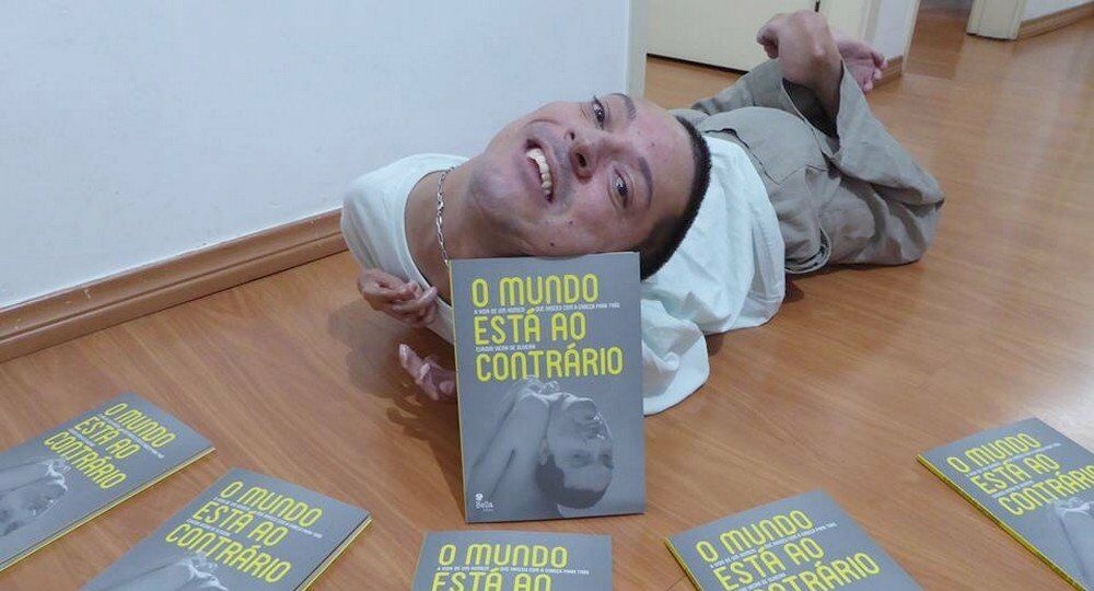 Chung benh khien nguoi mac bi lon nguoc dau anh 2