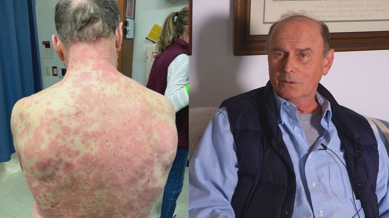 tac dung phu sau khi tiem vaccine anh 2