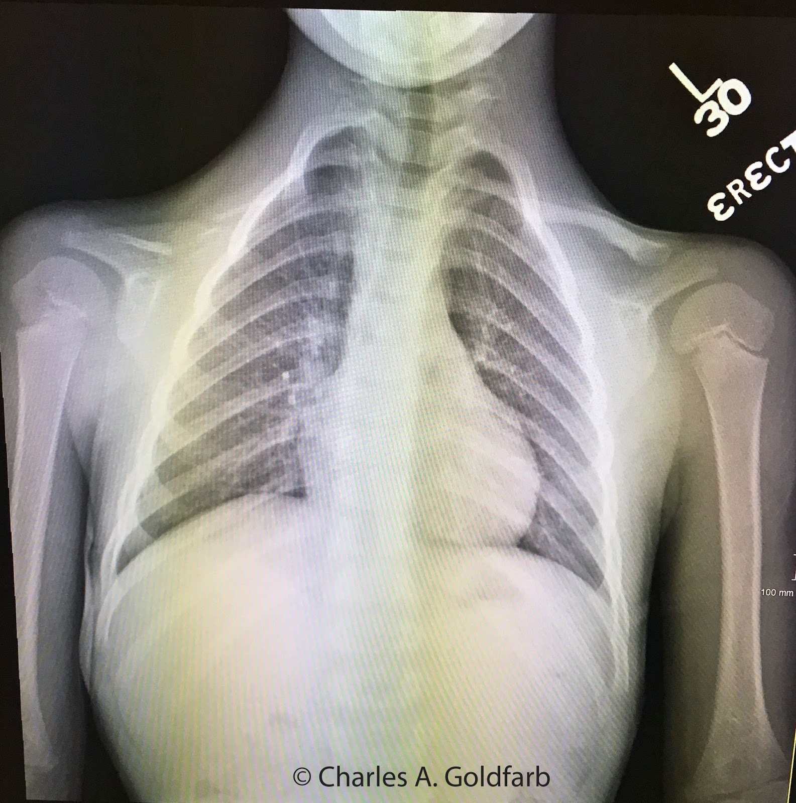 mat xuong quai xanh anh 4