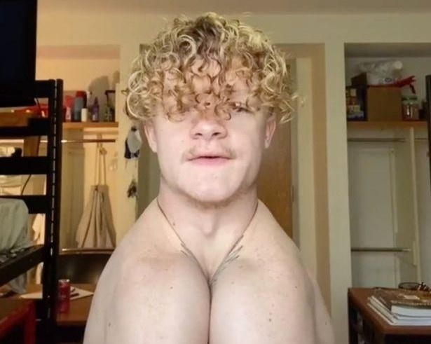 Can benh khien nguoi mac co the gap doi vai hinh anh