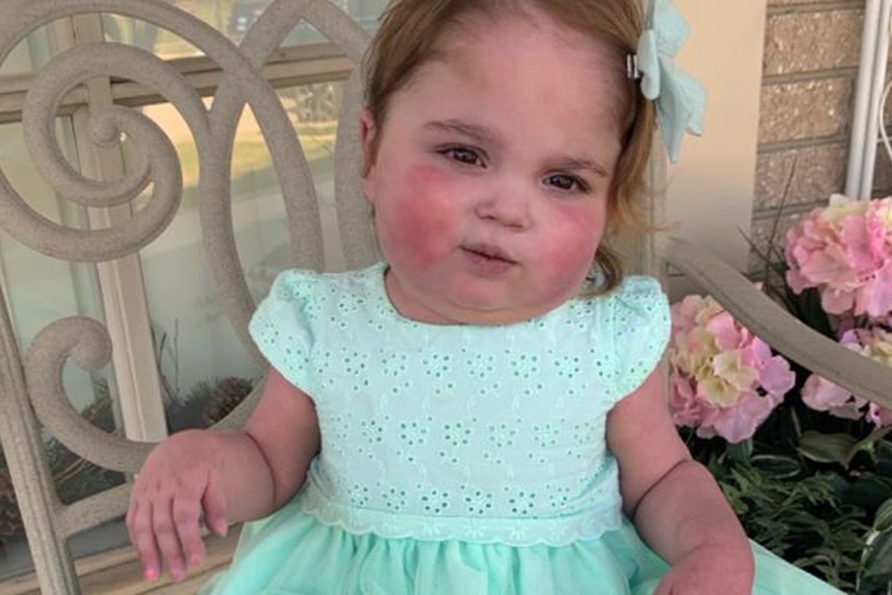 Can benh khien tre co the tu vong sau vai ngay chao doi hinh anh