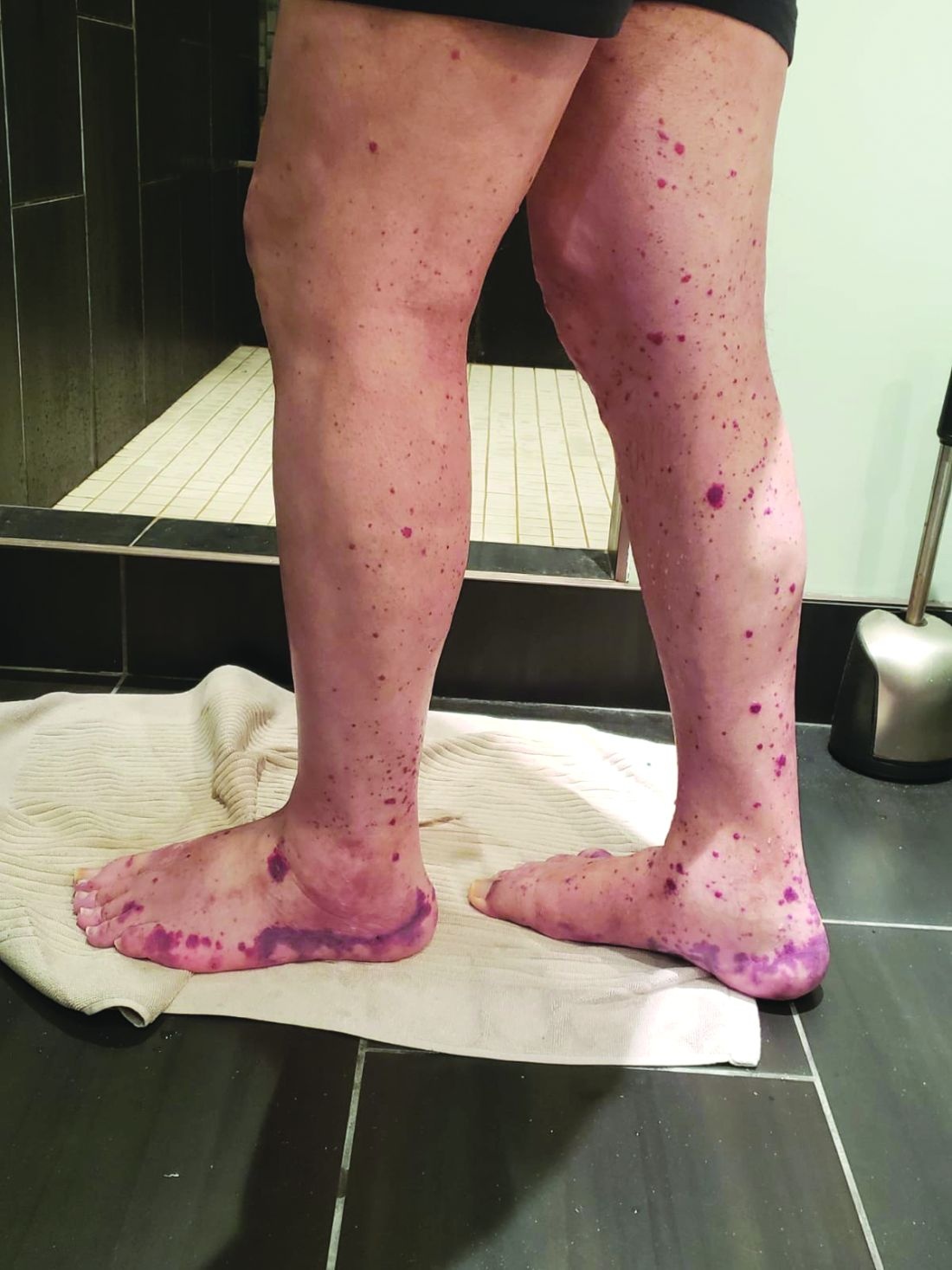 Can benh moi chi nam gioi mac anh 2