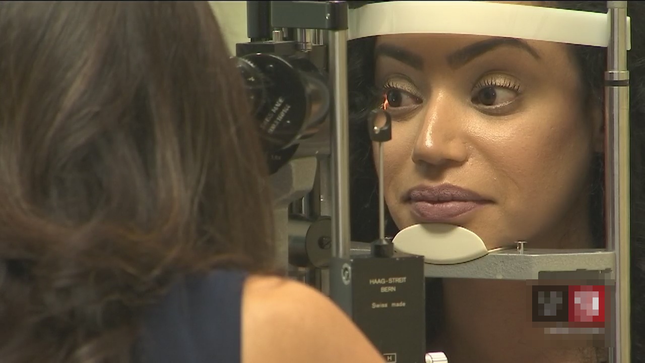 bo ve lam to tren mat sau khi noi mi anh 1