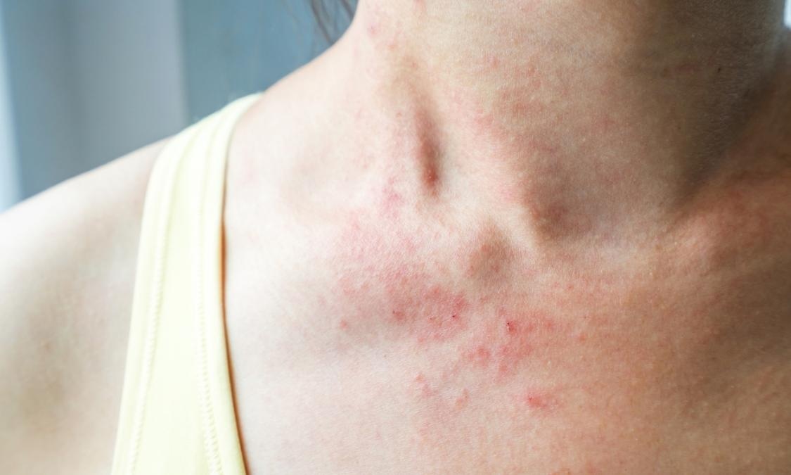 mat mang vi mot cu hanh anh 2