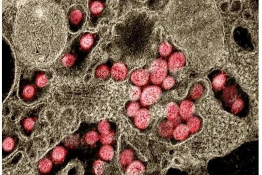 Tim ra khang the co kha nang uc che cac bien chung SARS-CoV-2 hinh anh