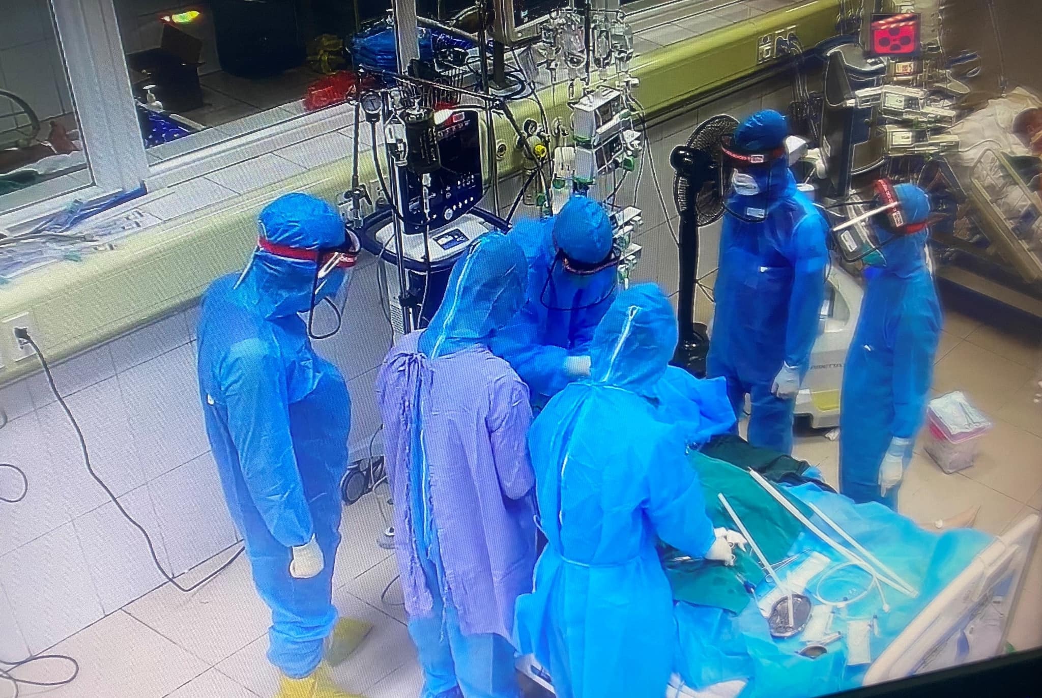 4 benh nhan Covid-19 nguy kich duoc can thiep ECMO hinh anh