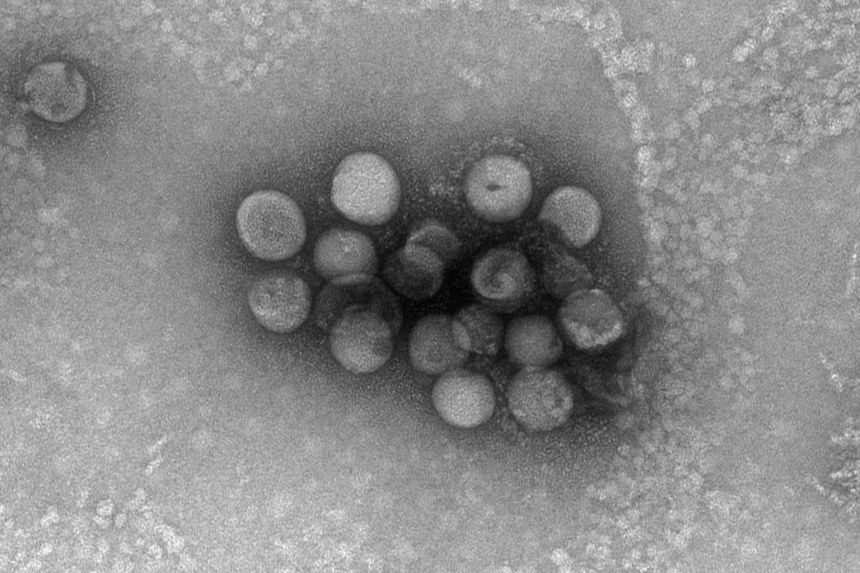 Chủng virus corona mới ảnh 1 Chung virus corona moi anh 1