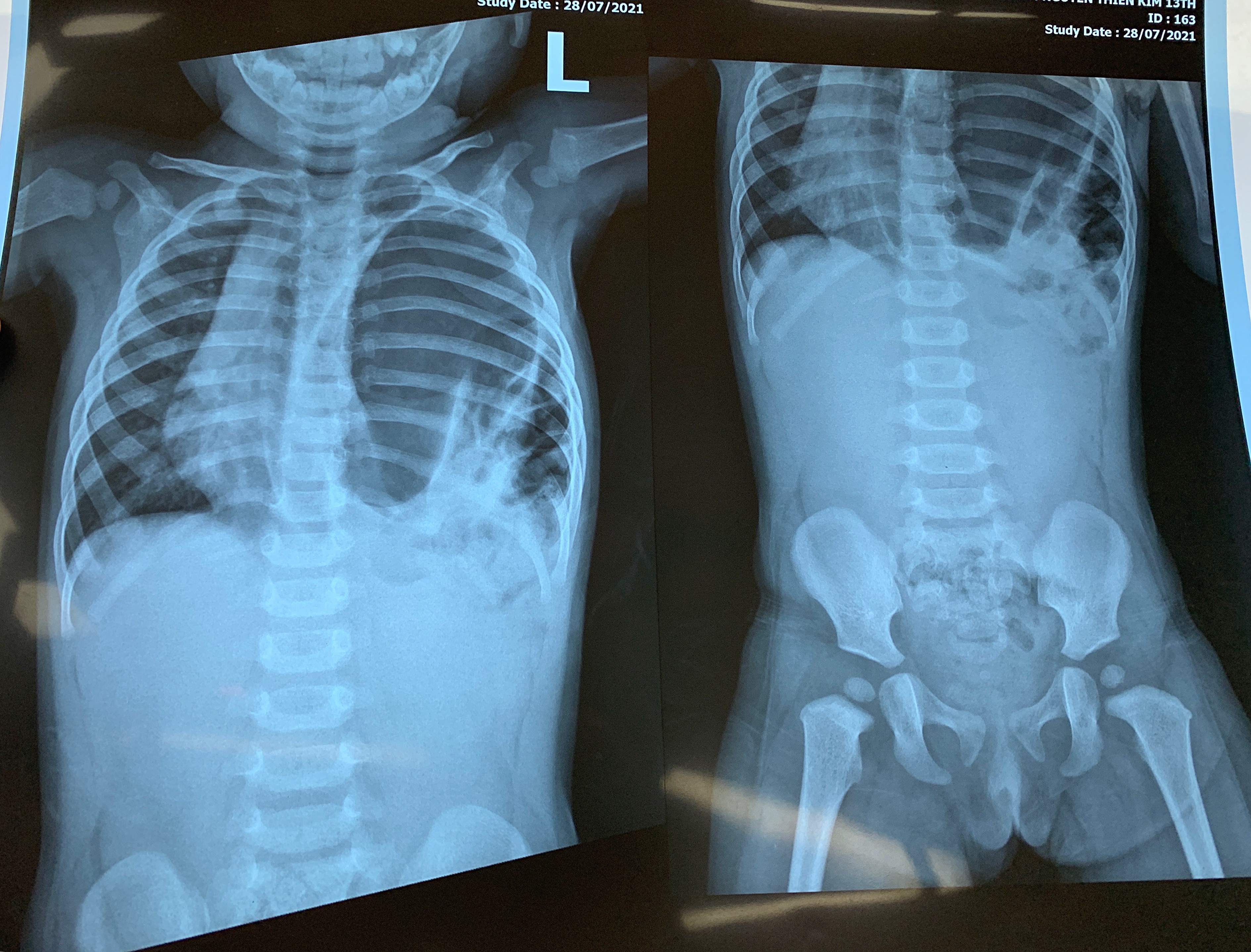 nguy kich vi benh hiem gap anh 1