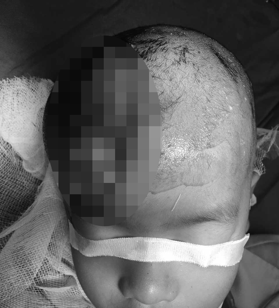 tai nạn ở trẻ nhỏ ảnh 1 tai nan o tre nho anh 1