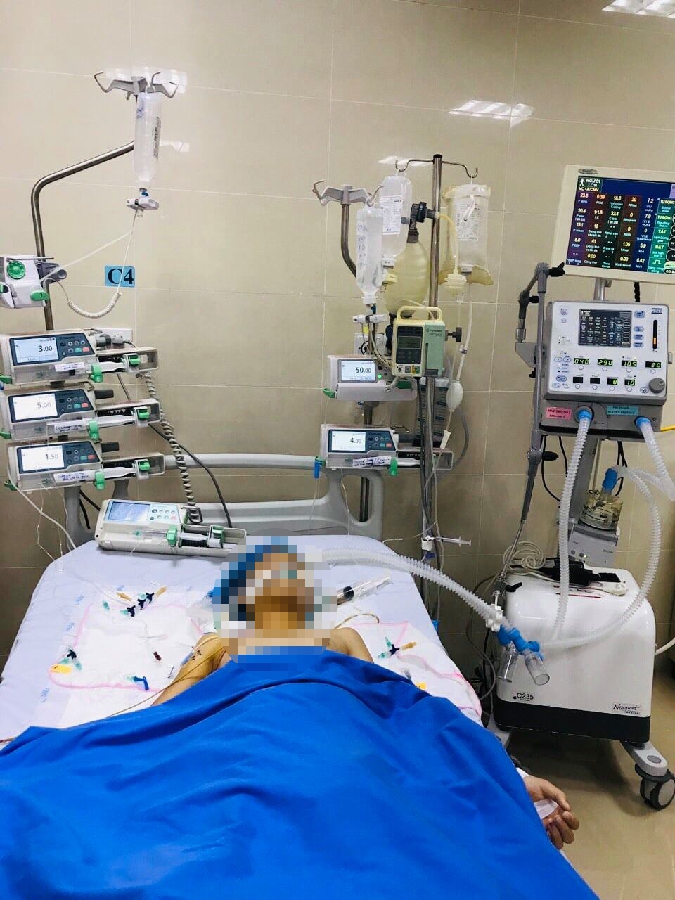 soc phan ve khi uong paracetamol anh 1