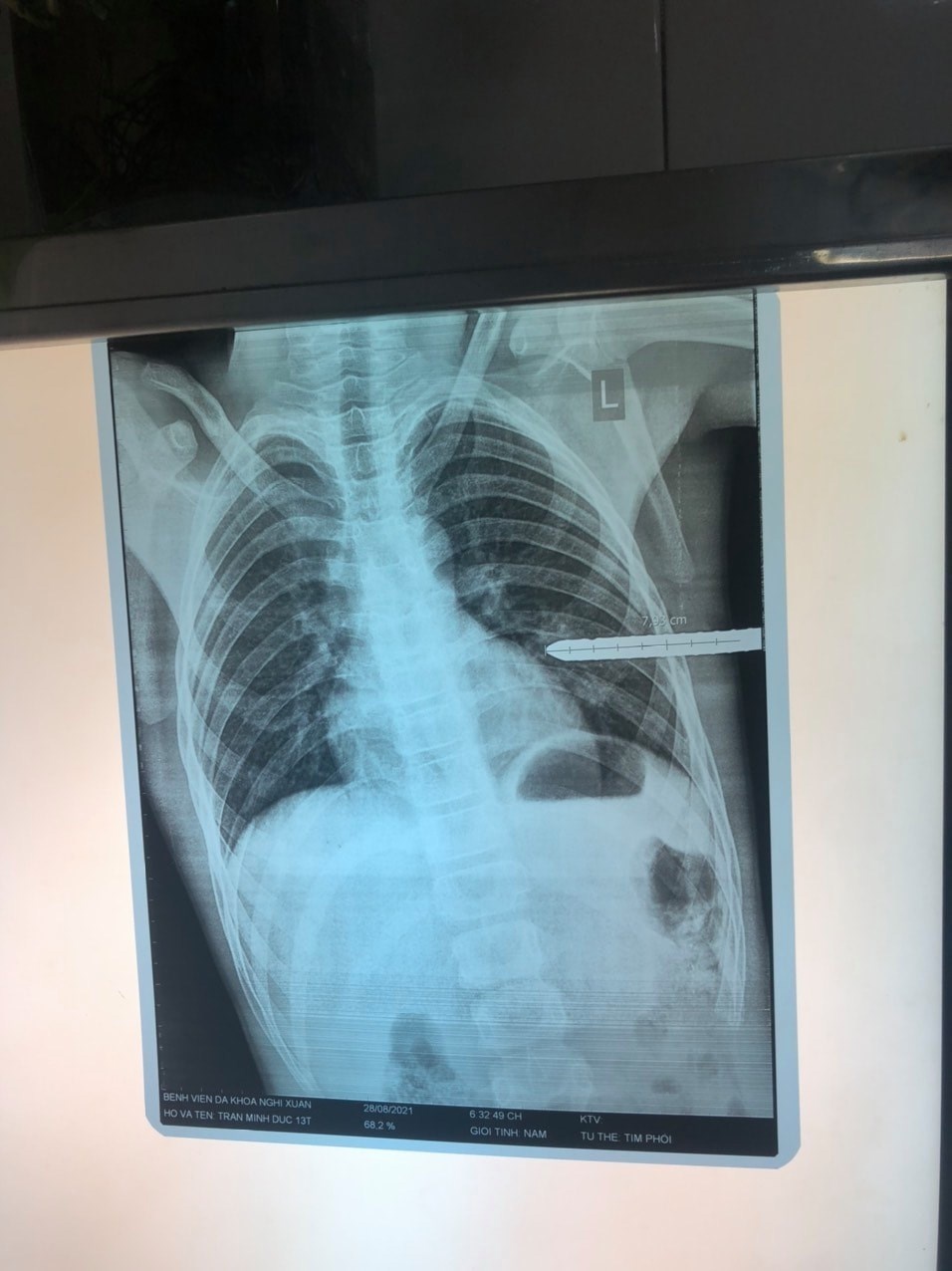 thanh sat dam thau nguc anh 1