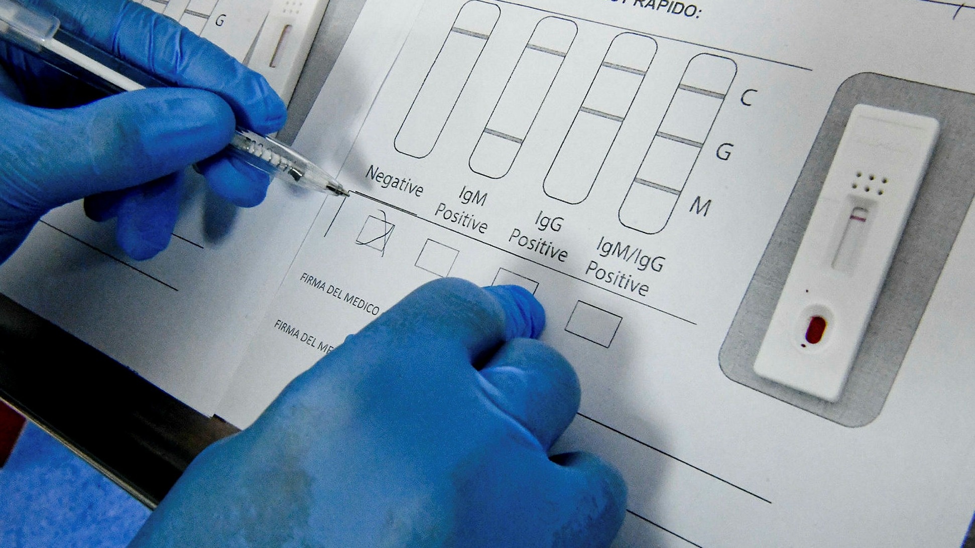 Ly do khong nen test khang the cho nguoi tiem vaccine Covid-19 hinh anh