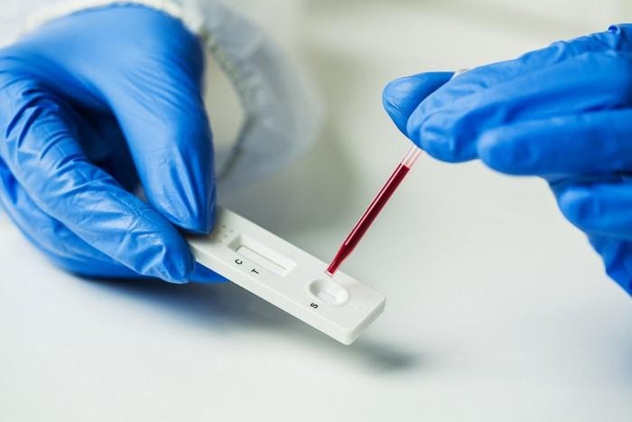 Toi co nen test khang the sau tiem vaccine Covid-19? hinh anh