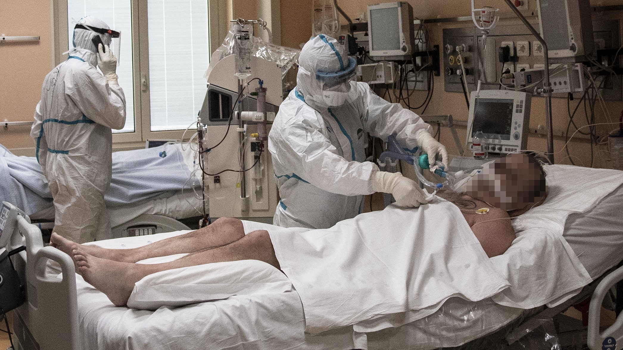 Ly do nam gioi de tu vong hon phu nu khi mac Covid-19 hinh anh