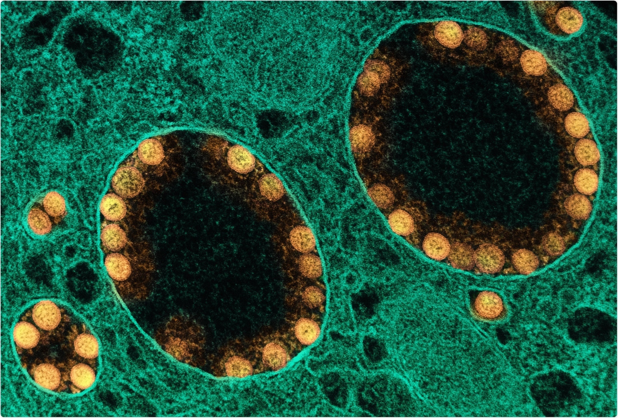 Phat hien dot pha ve thuoc chua Covid-19 hinh anh