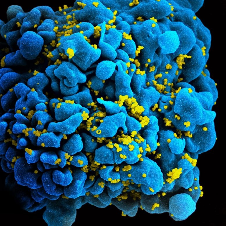 cách điều trị HIV ảnh 1 cach dieu tri HIV anh 1
