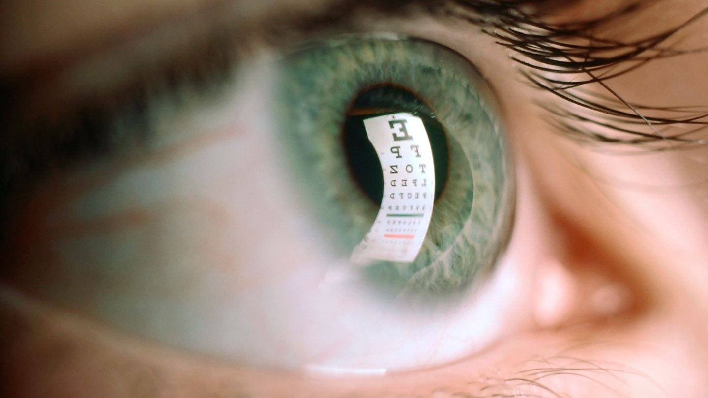 trieu chung la anh 2